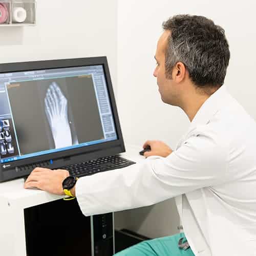 Tratamiento medico-quirurgico del pie en Gijon